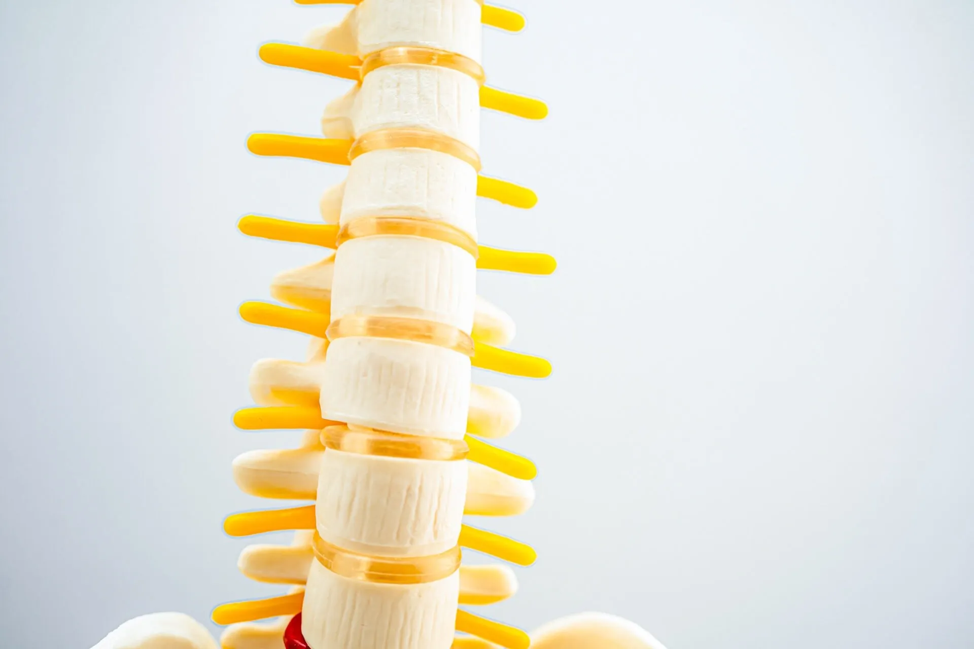 A close-up side view of a human spine model showing off-white vertebrae, yellowish discs, and yellow nerve roots against a light grey background.